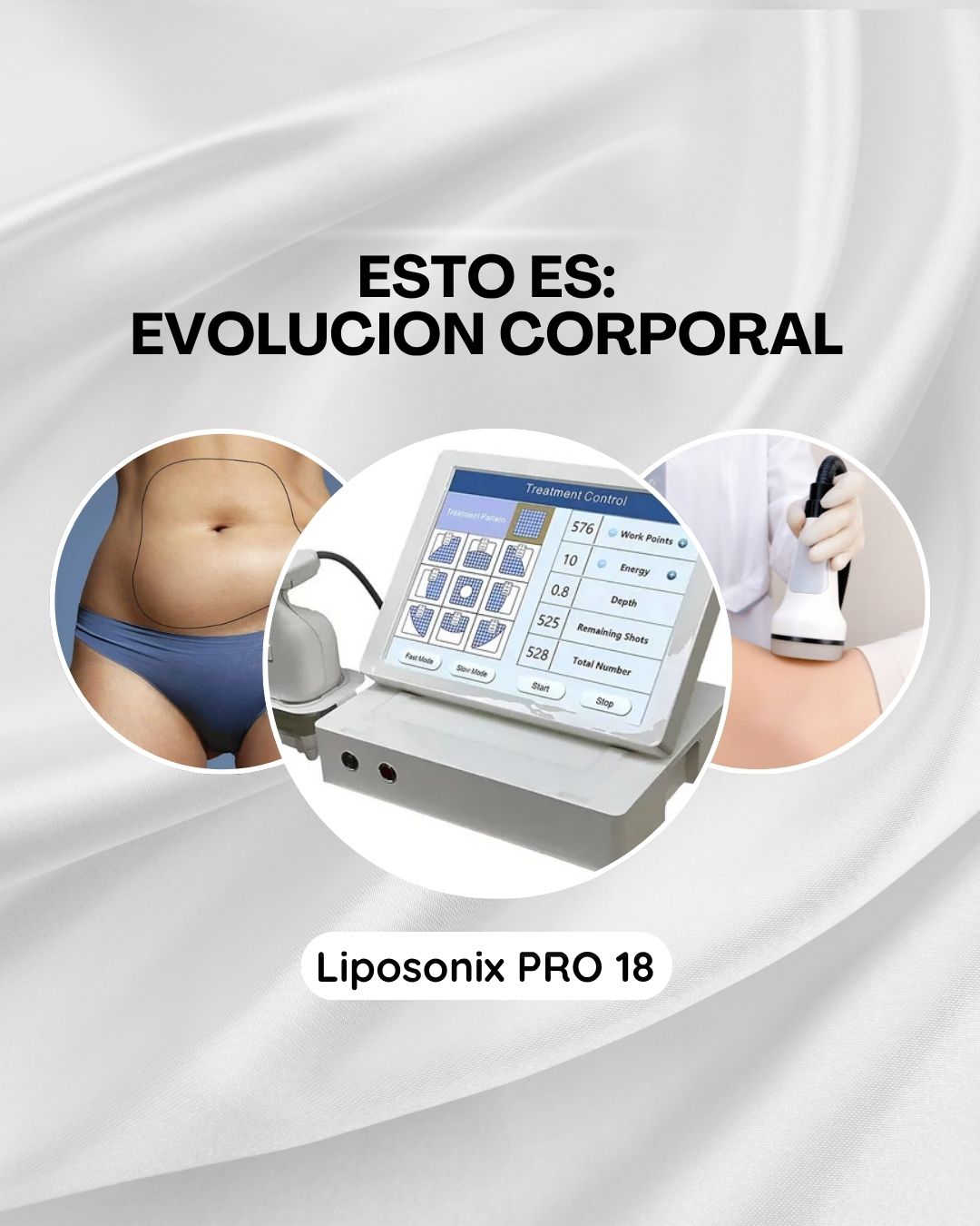 Formate como EXPERTA en Liposonix